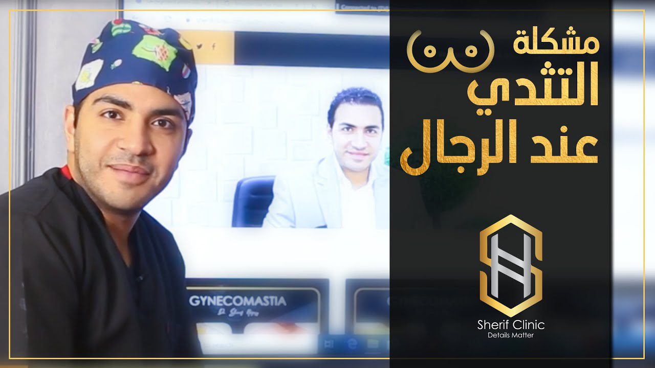علاج تثدي الرجال بدرجاته المختلفة