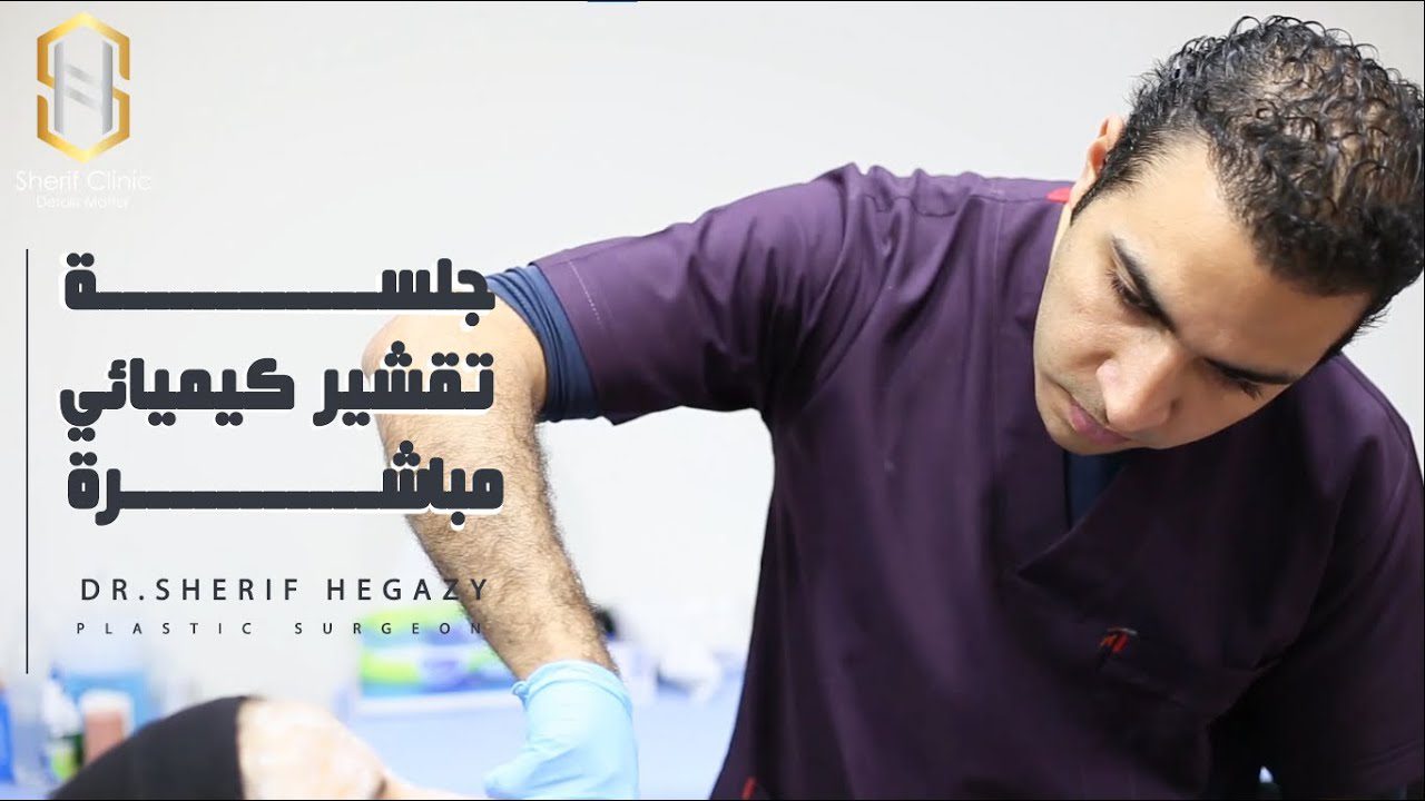 جلسة تقشير مباشرة