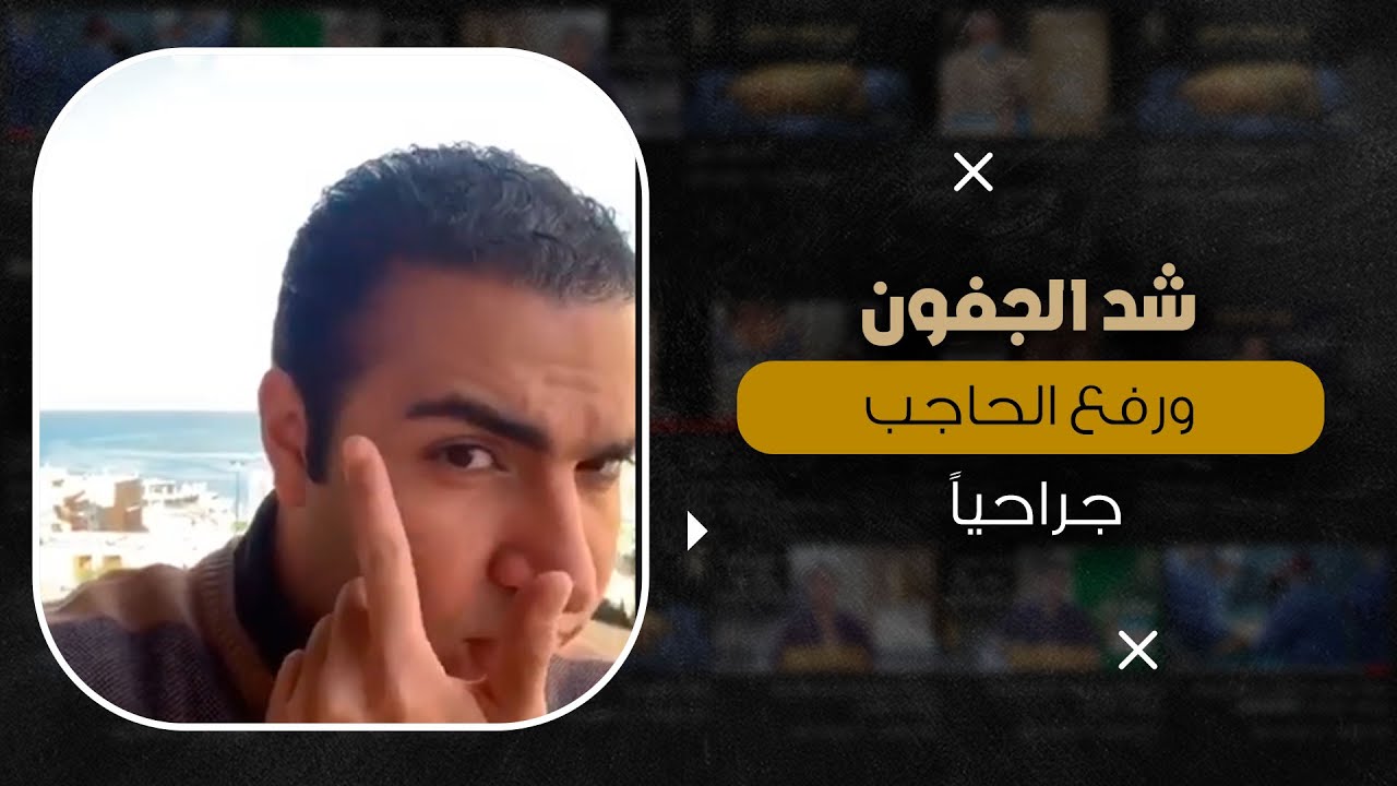 شد الجفون ورفع الوجه جراحياُ