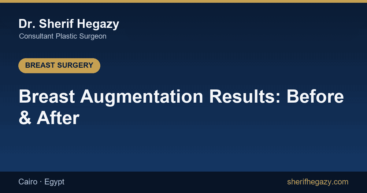 Breast Augmentation Results: Before and After