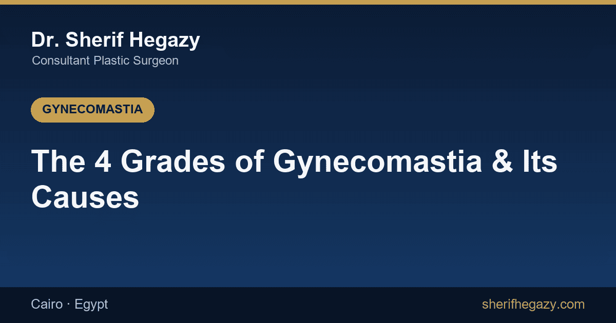 The 4 Grades of Gynecomastia, Its Causes, and Does It Cause Infertility?