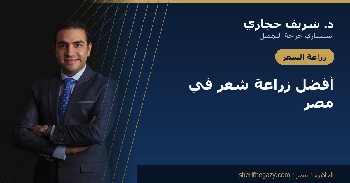 أفضل دكتور زراعة شعر في مصر - الدكتور شريف حجازي