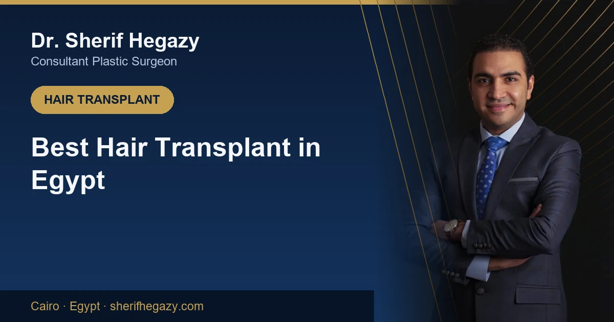 Best hair transplant in Egypt - Dr. Sherif Hegazy