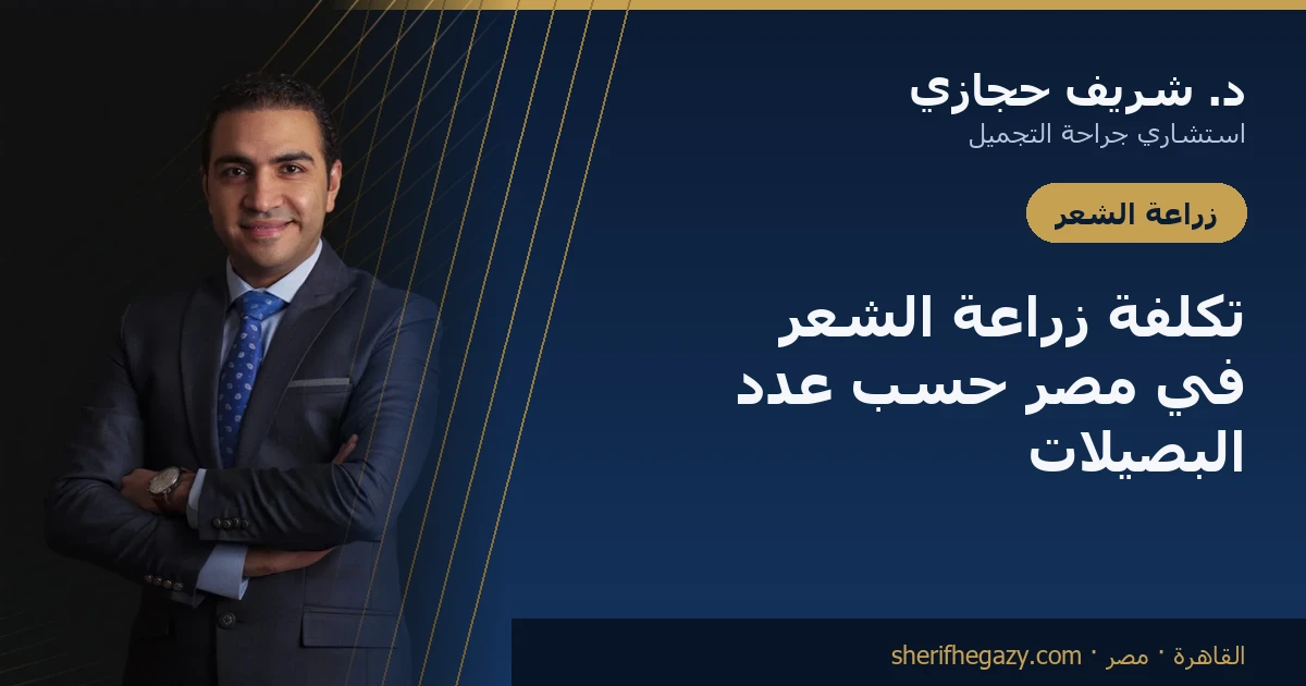 تكلفة زراعة الشعر في مصر حسب عدد البصيلات