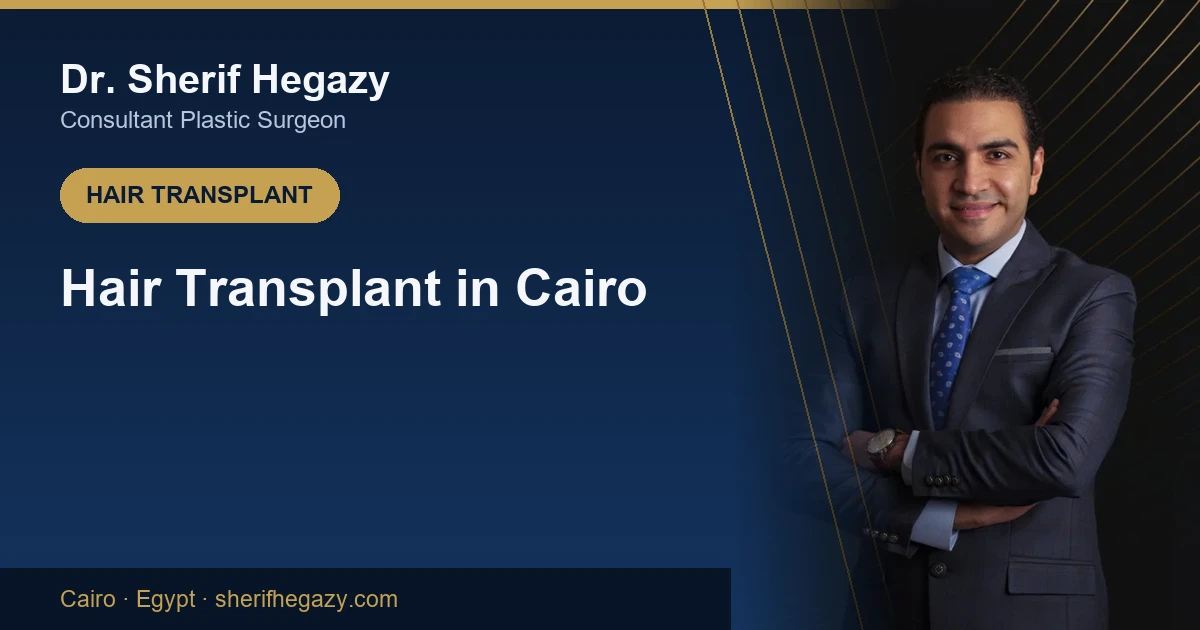 Hair Transplant in Cairo: Where to Go and What to Expect