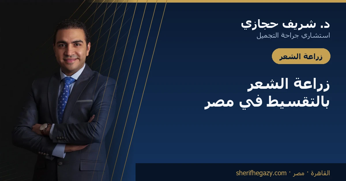 زراعة الشعر بالتقسيط في مصر: ادفع على أشهر