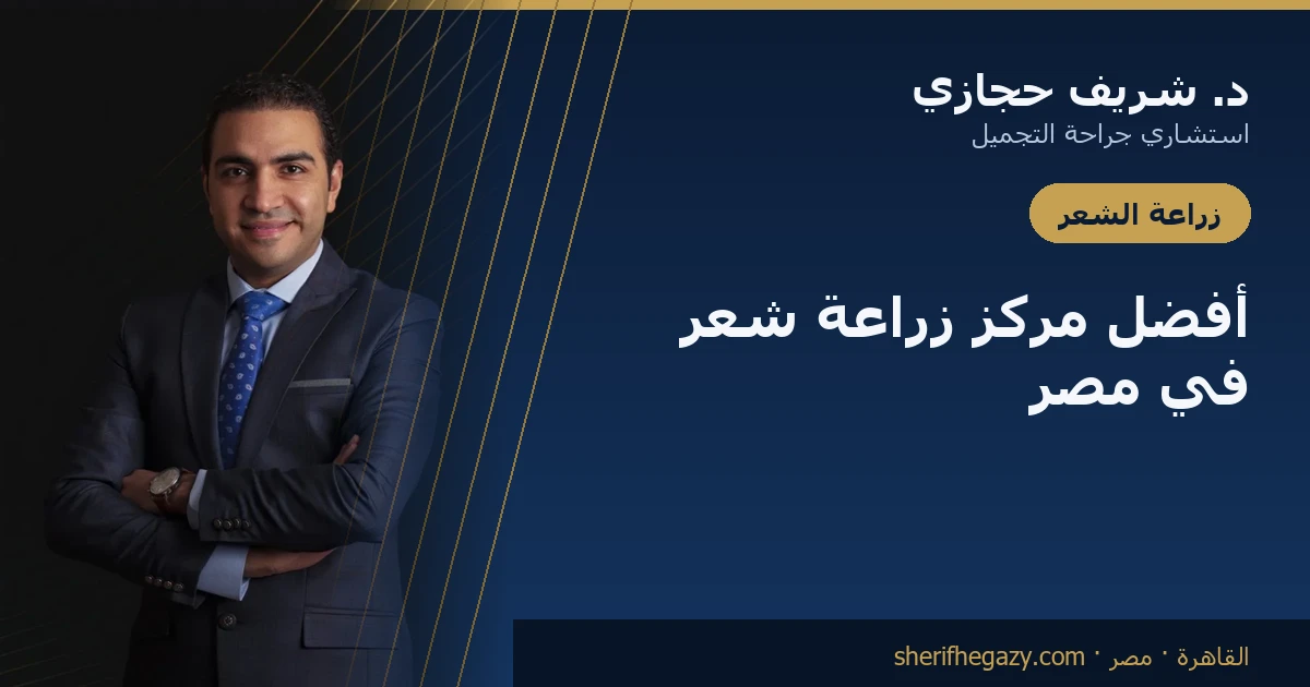 كيف تختار أفضل مركز زراعة شعر في مصر