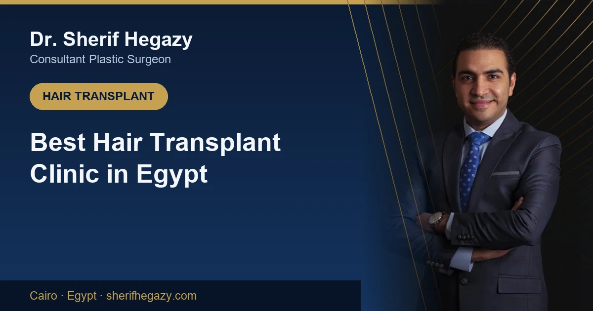 How to Choose the Best Hair Transplant Clinic in Egypt