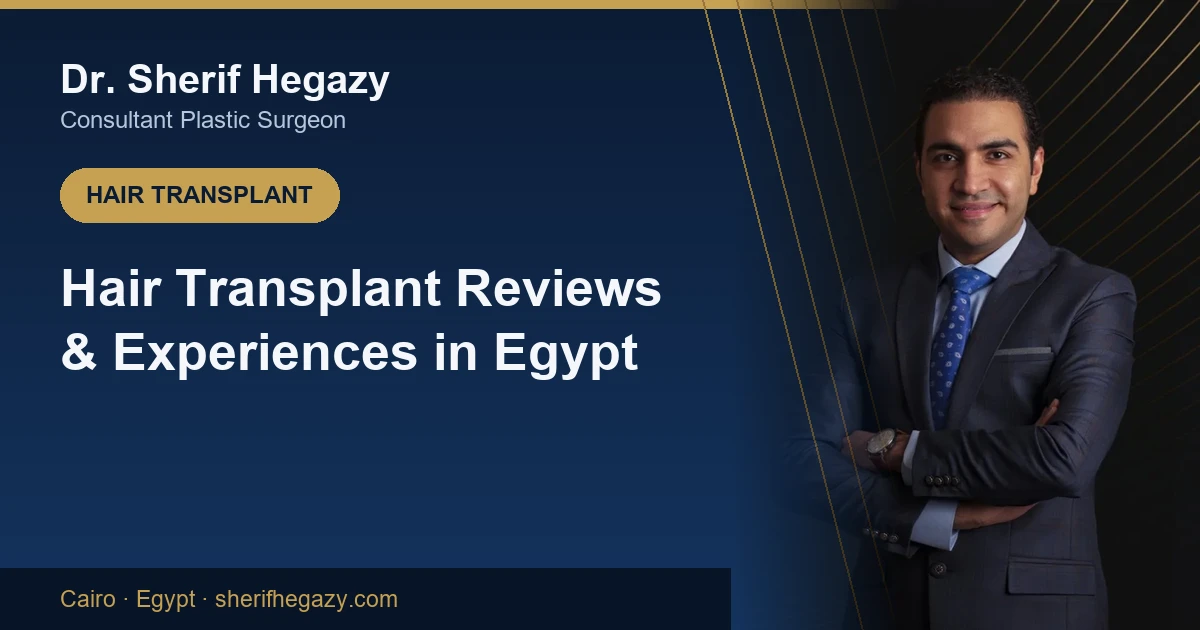 Hair Transplant Reviews and Real Experiences in Egypt