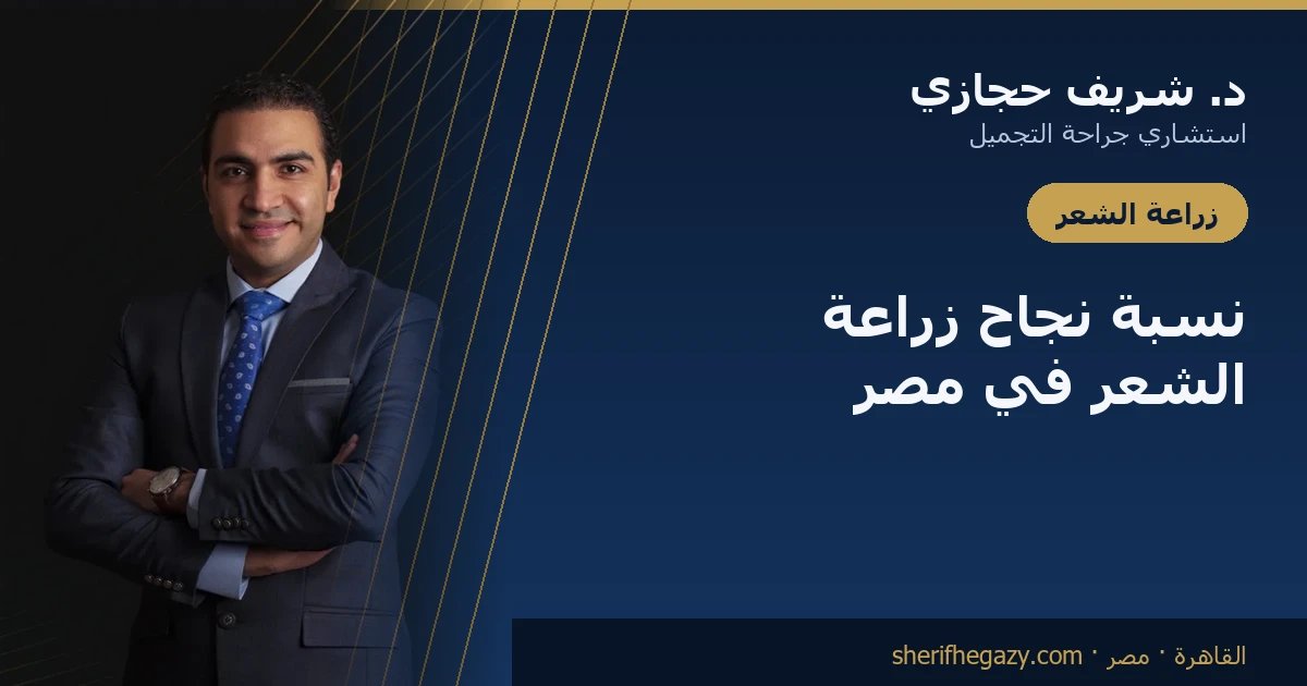 نسبة نجاح زراعة الشعر في مصر: ما الذي تتوقعه