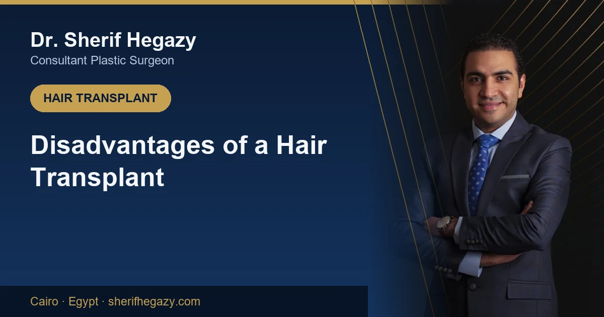 Disadvantages of a Hair Transplant (and How to Avoid Them)