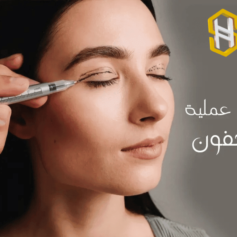 عملية شد الجفون