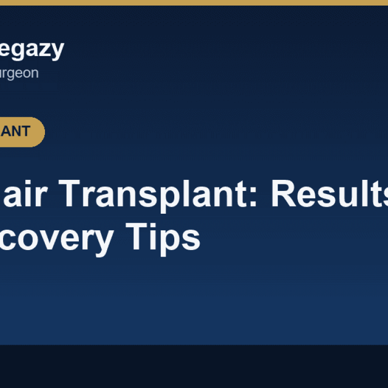Beard Hair Transplant: Results and 6 Tips for a Fast Recovery