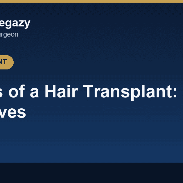 Benefits of a Hair Transplant: 4 Goals the Procedure Achieves