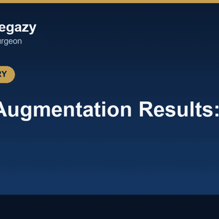Breast Augmentation Results: Before and After
