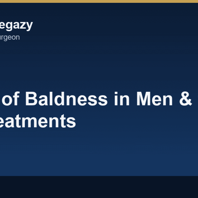 Causes of Baldness in Men and the Best Treatments