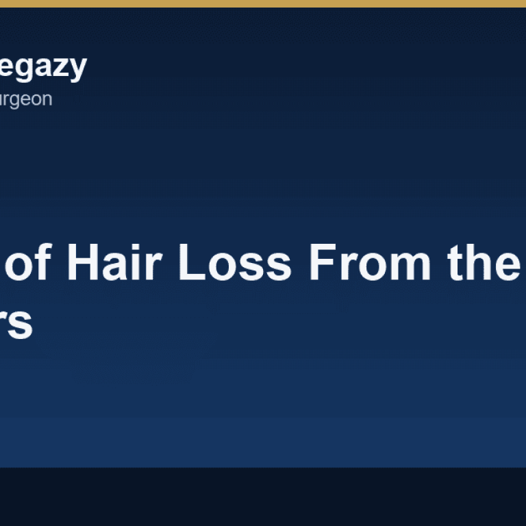 Causes of Hair Loss From the Roots: 7 Factors You Should Know