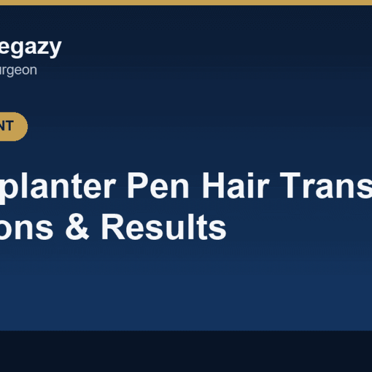 Choi Implanter Pen Hair Transplant: Pros, Cons, Results & Cost