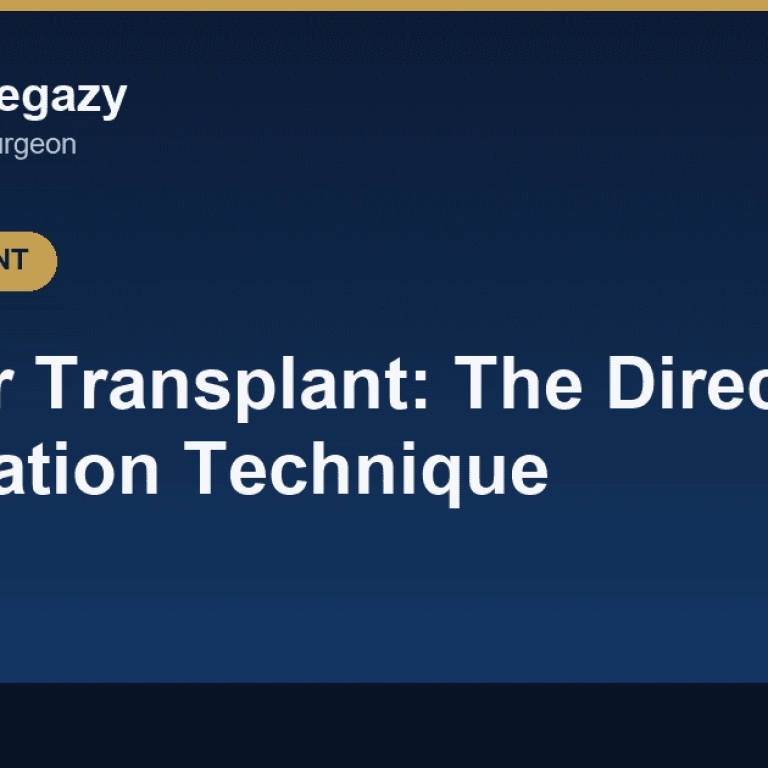 DHI Hair Transplant: The Direct Implantation Technique Explained