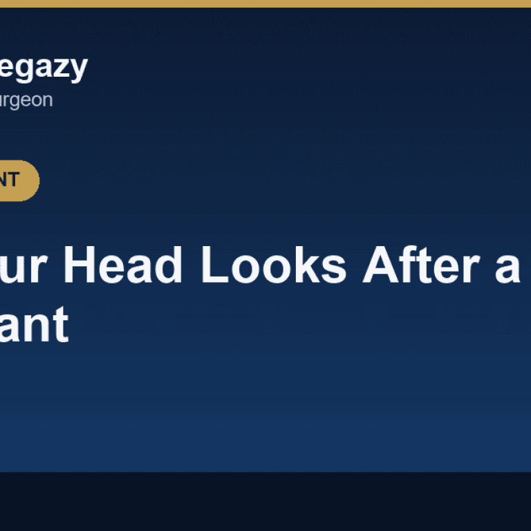 How Your Head Looks After a Hair Transplant: Growth Stages