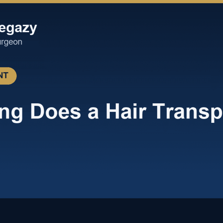 How Long Does a Hair Transplant Take? 5 Factors That Control the Result