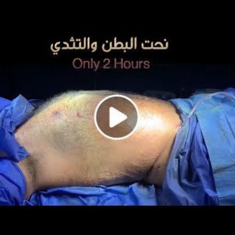 نحت البطن والتثدي في ساعتين فقط