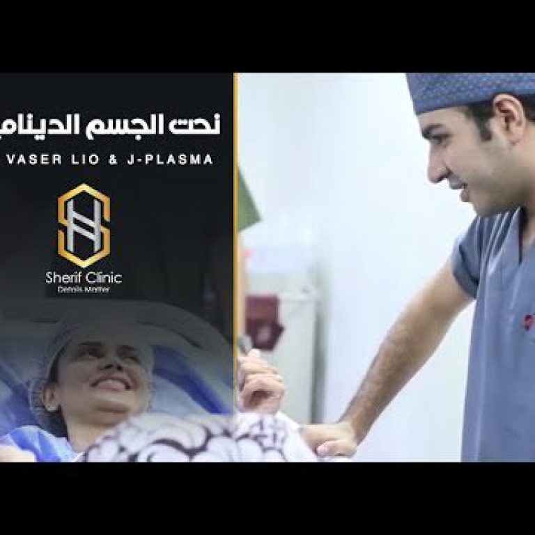 شفط دهون لأحد الحالات شاهد الفرق قبل وبعد