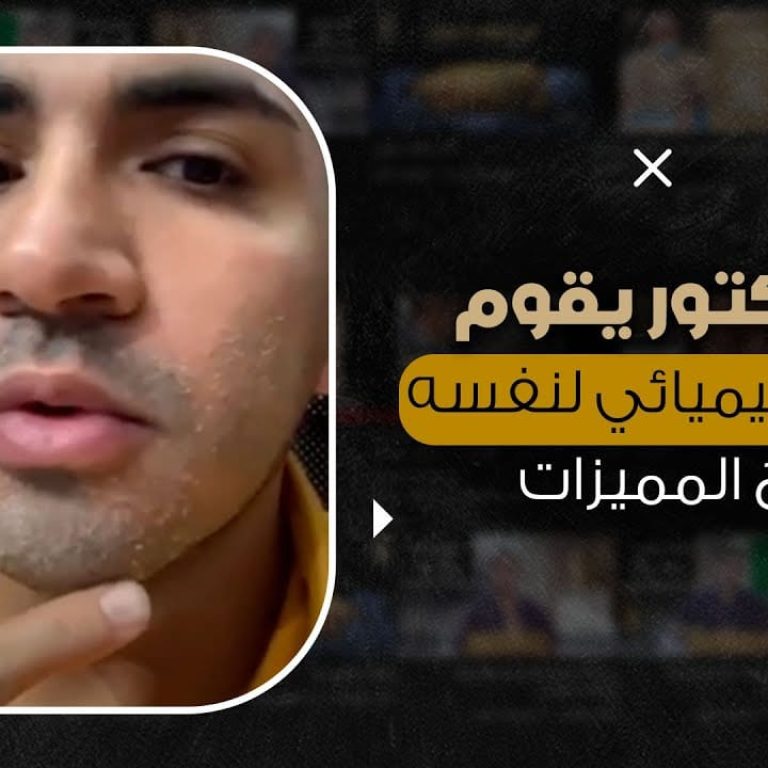 اول دكتور يقوم بتقشير كيميائي لنفسه وشرح المميزات