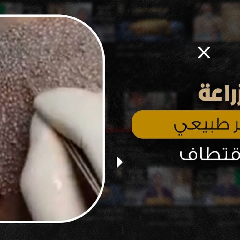 زراعة شعر طبيعي بالاقتطاف
