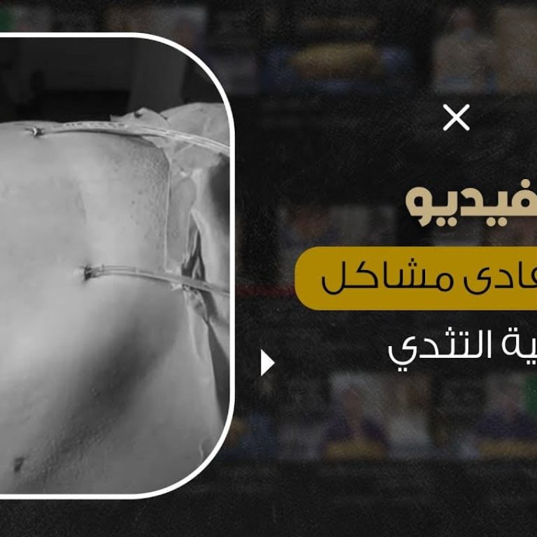 كيف نتفادى مشاكل عملية التثدي