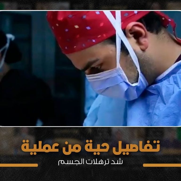 مباشرة شد ترهلات الجسم من داخل غرفة العمليات