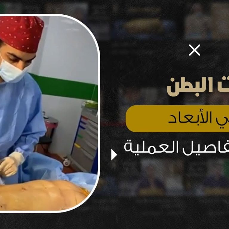 تفاصيل شفط الدهون من غرفة العمليات