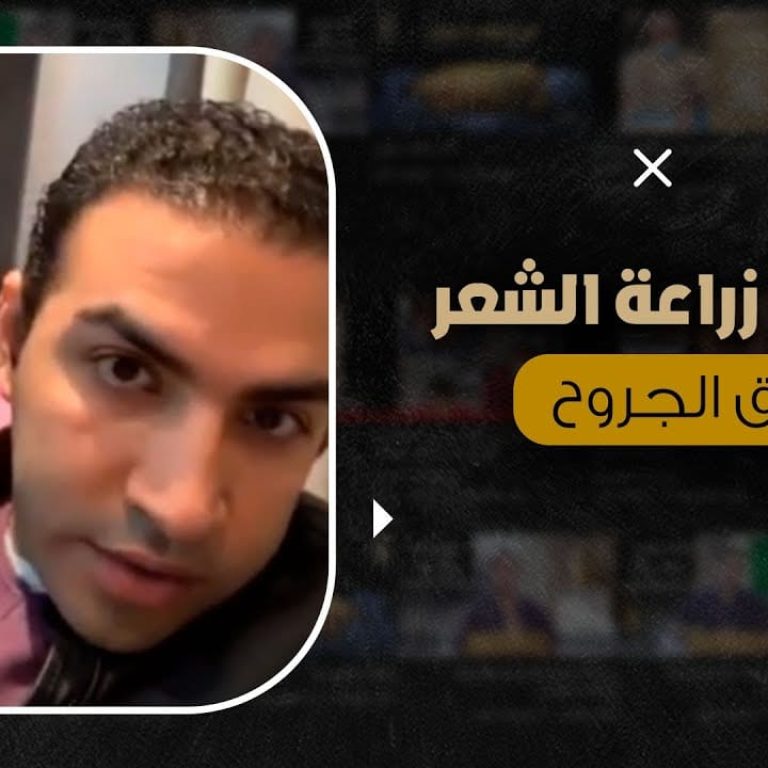 حقيقة زراعة الشعر فوق الجروح و الحروق