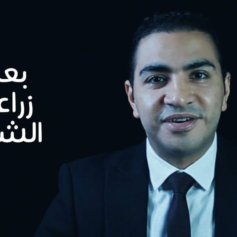 ماذا بعد زراعة الشعر