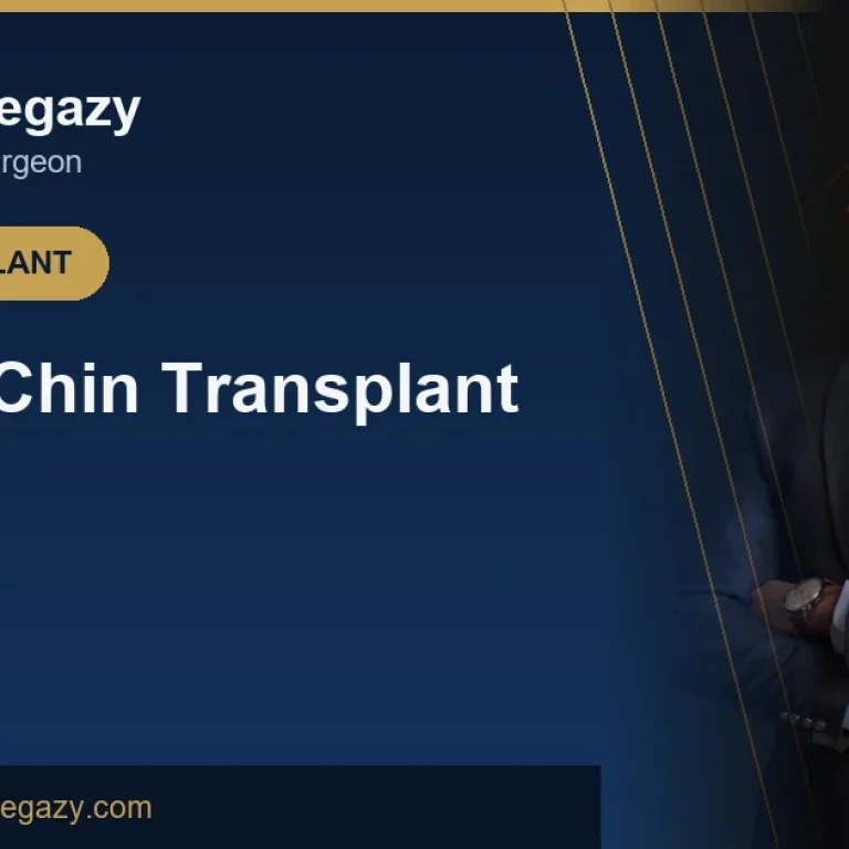 Beard and Chin Transplant in Egypt: A Full Beard for Life